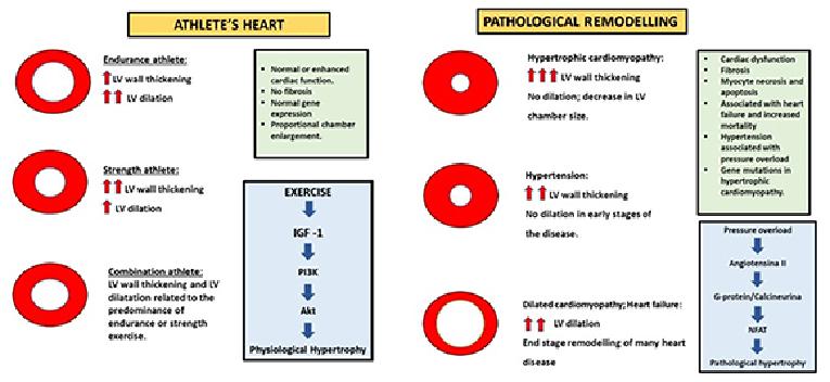 Cardiac Dysfunction And Athlete’s Heart: New Insights Into ...